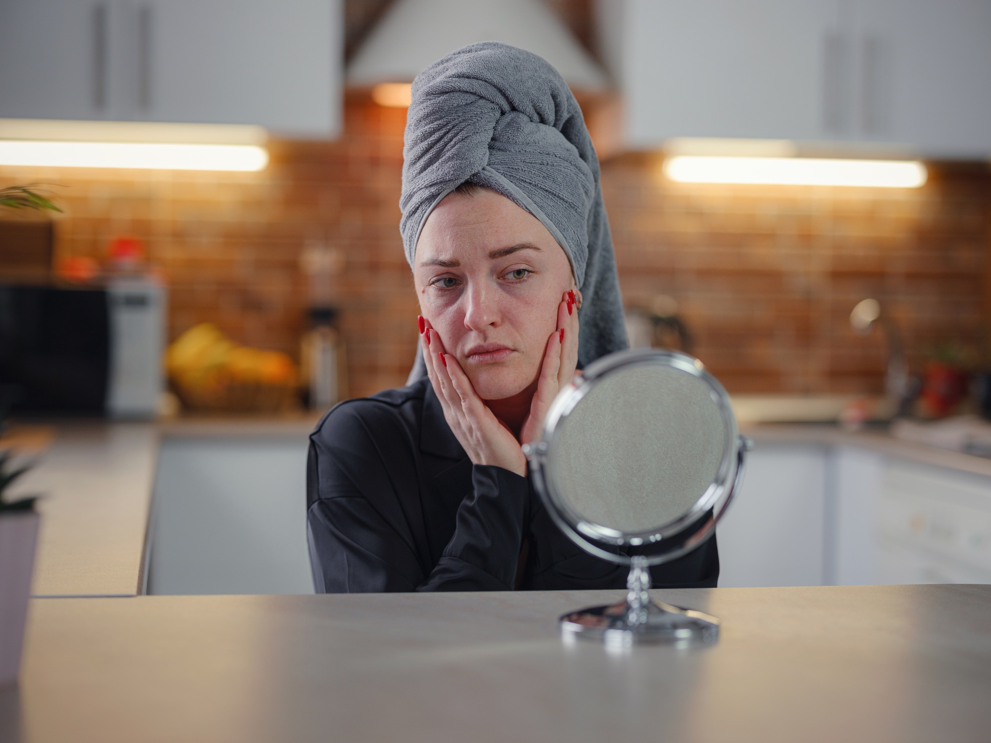 Conceptual shot of Acne and Problem Skin on female face.